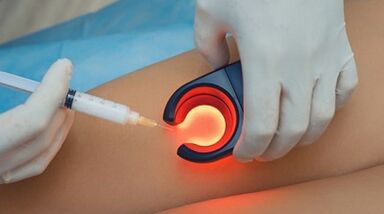 Venosclerosis terapia barizeak